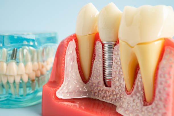 Best Dental Exams and Cleanings  in Lebanon, MO